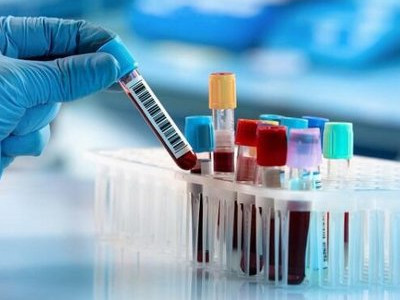 Үнді штамы еліміздің барлық өңірінде анықталды – Денсаулық министрлігі