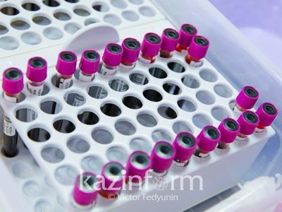 Коронавирусқа қатысты әлемдегі жағдай