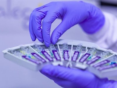 1433 адам коронавирус инфекциясынан жазылып шықты