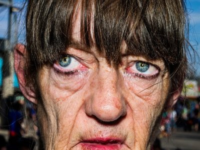 Признаки того, что вы уже переболели коронавирусом