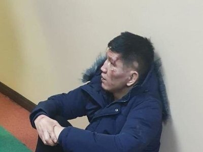 «Есінен тана береді» Желіде Қуат Хамитовтың жараланған фотосы тарап кетті (Фото)