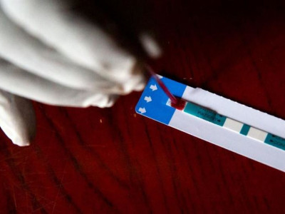 ДДСҰ ВИЧ-инфекциясының алдын алатын жаңа препаратты пайдалануға кеңес берді 