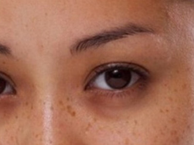 Көздің асты қара болуы не білдіреді?