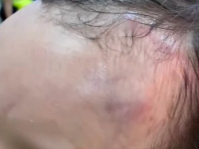 Павлодардағы балабақшада 2 жасар бала соққыға жығылған