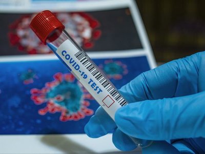 Дәрігер COVID-19 Пирола жаңа штаммының негізгі белгілерін атады