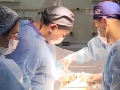 Дәрігерлер пациенттің құртқа толы бауырына ота жасады