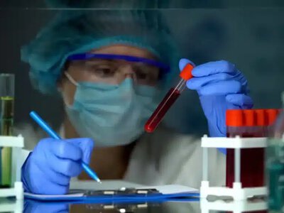 Әлемде АИТВ індеті қайта өршуі мүмкін – БҰҰ