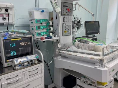 679 грамм болып туған: дәрігерлер 70 күн бойы шақалақтың өмірі үшін күресті